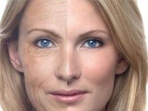 Теринин пигментациясы